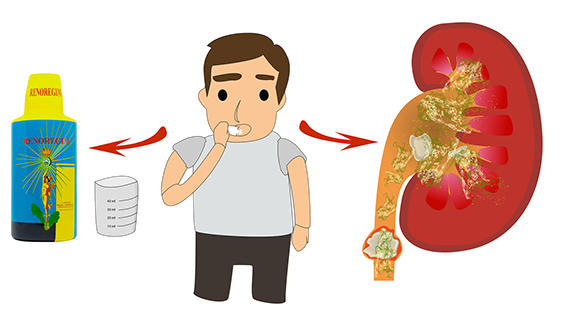 pietre-la-rinichi-renoregim